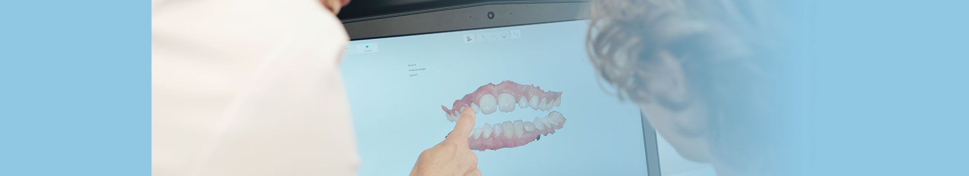 Desinclusión supernumerarios